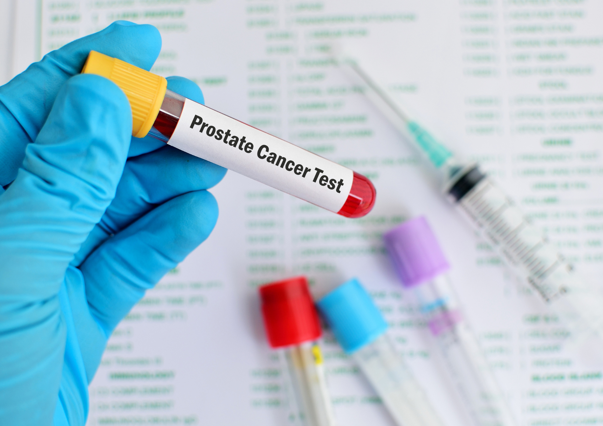Prostate Cancer